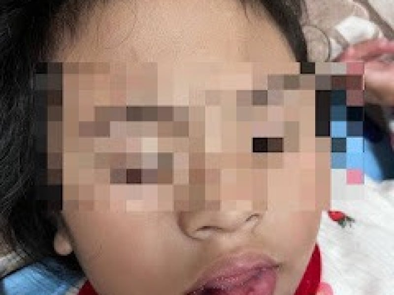 台東特幼班虐童案引眾怒 立委、家長齊聲譴責 要求教育部徹查