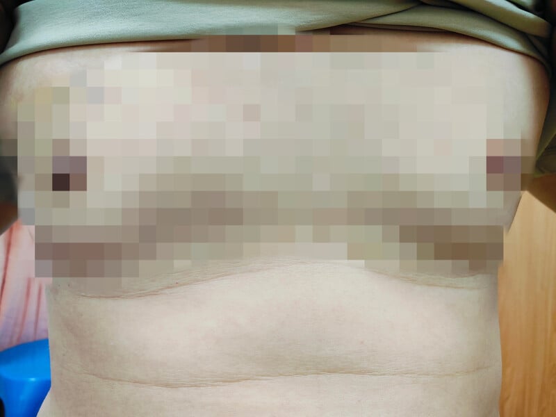 女乳症01_4e380.jpeg