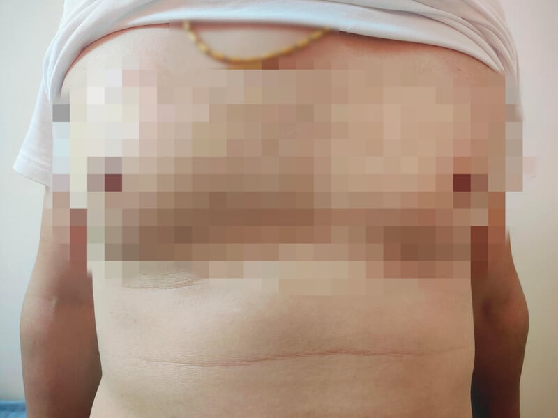 女乳症_30eb3.jpeg