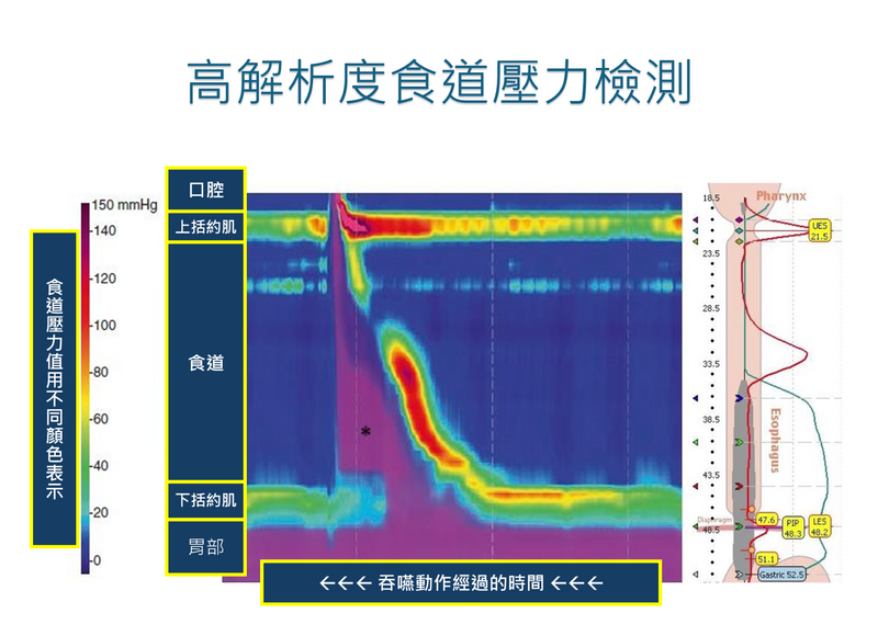 食道壓力檢測圖_240f9.png